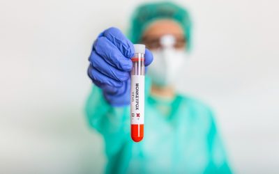 Monkeypox Virus Blood Test