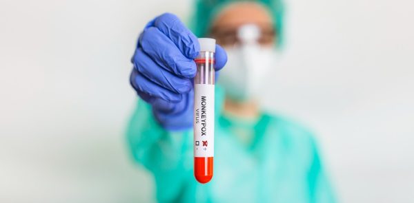 Monkeypox Virus Blood Test